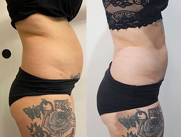 weight loss
