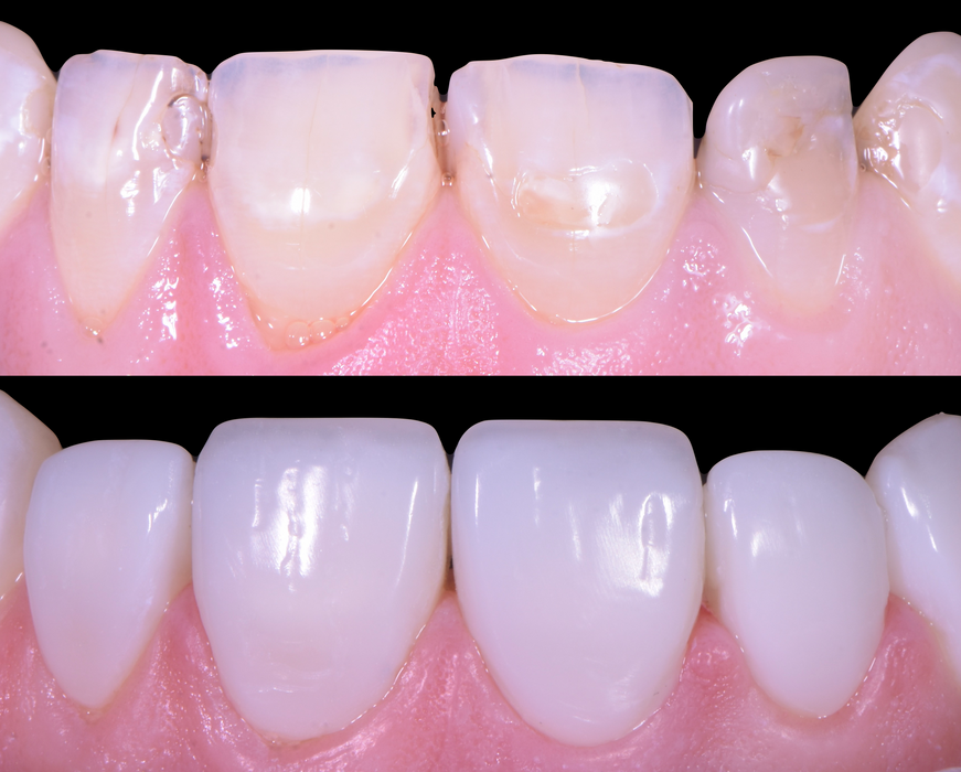 Screenshot 2023-07-19 at 23.11.12.png