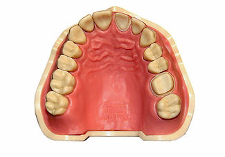 Практический курс "Препарирование зубов под металлокерамические и безметалловые конструкции (коронки)" Копировать