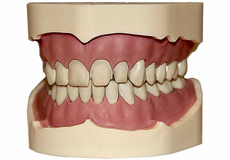 Практический курс "Виниры. Часть 1. Препа