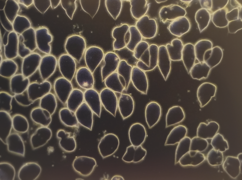 Bild 1: die «zitronenförmige» Blutkörperchen