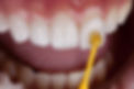 Dental, Smile design, White teeth.jpg