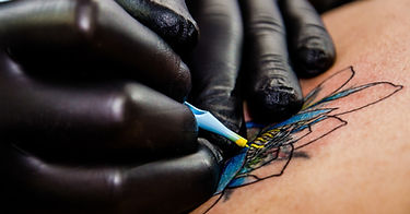 Tattoo removal