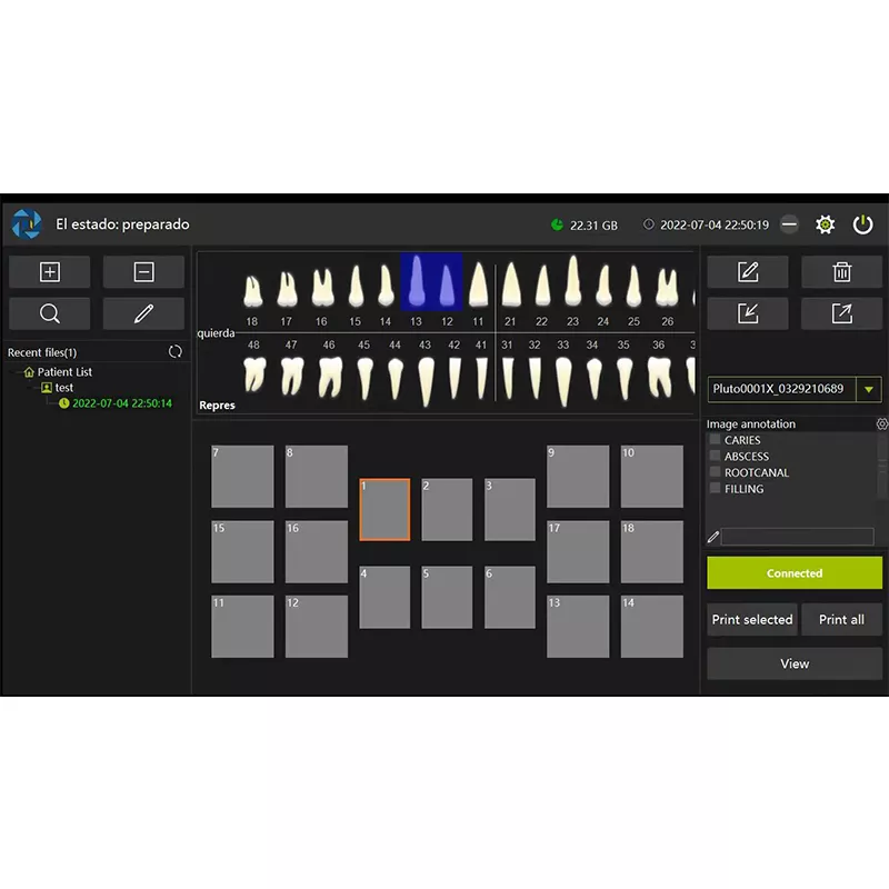 Digital Dental sensor | DynairDental