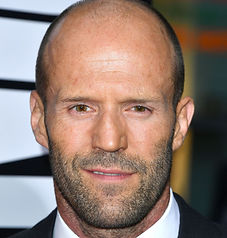 jason statham-hair-transplant.jpeg