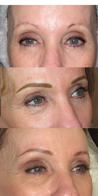 Cosmetic Ink Before After Portfolio