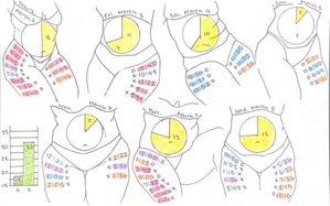 "How Much I Worry About My Appearance" Data Visualization