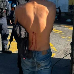 Tentativa de assalto termina com criminoso baleado em Pilares