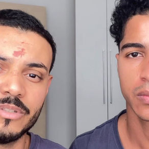 Casal denuncia agressão e homofobia ao sair de festa na UFRJ