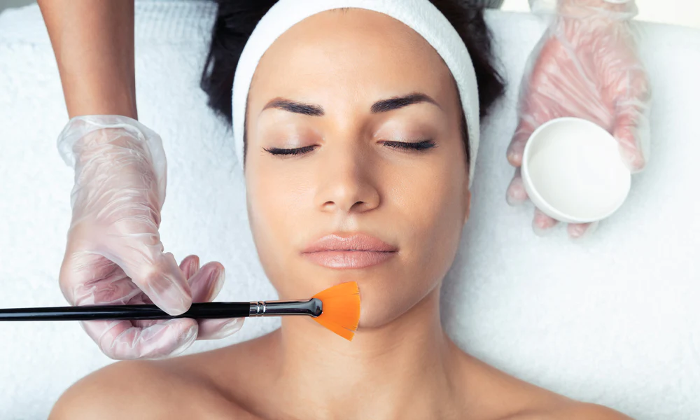 Chemical_Peel_1000x600px.webp