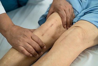 asian-senior-or-elderly-old-lady-woman-patient-sho-2026-01-08-06-04-48-utc_11zon.jpg