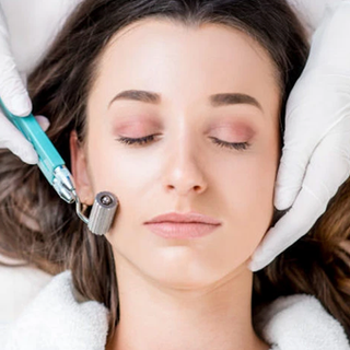 MICRONEEDLING SKINCARE TREATMENT.webp