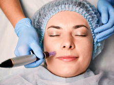 Best Exosome Hair Therapy and Microneedling in Bakersfield