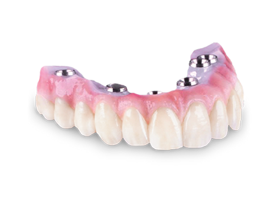 Implant Support Zirconia Hybrid.png