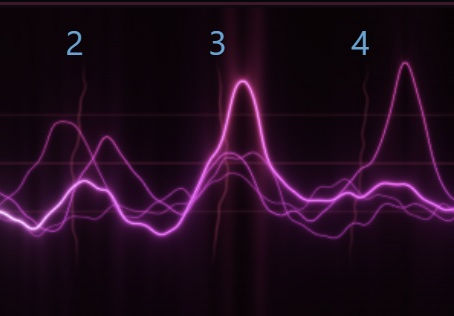 A squiggly line graph running across 5 data points.