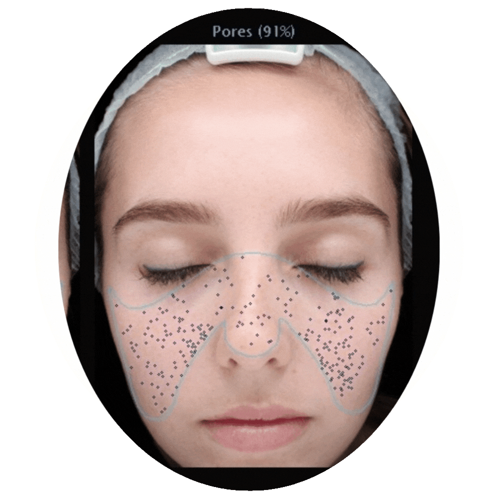 Skin Analyzer