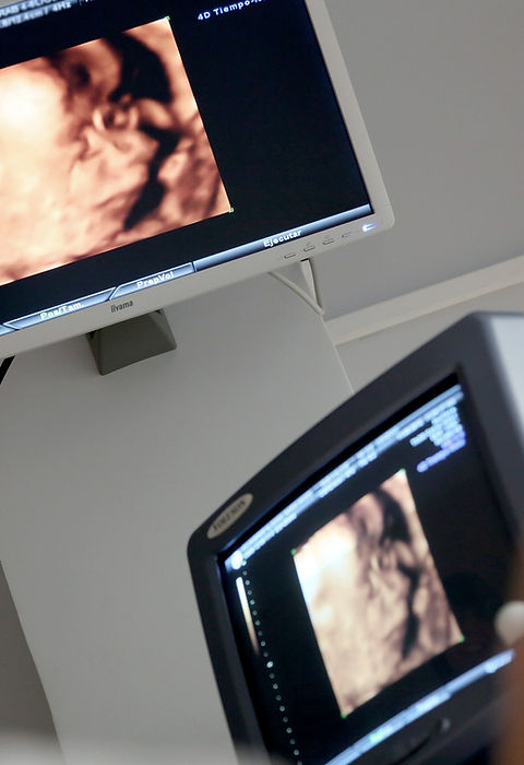 3d Ultrasound
