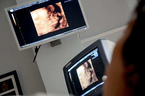 3d Ultrasound