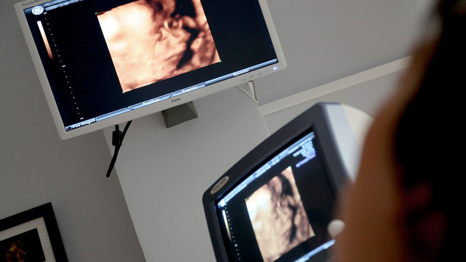 A Different Take on the President of Planned Parenthood's Visit to UCLA