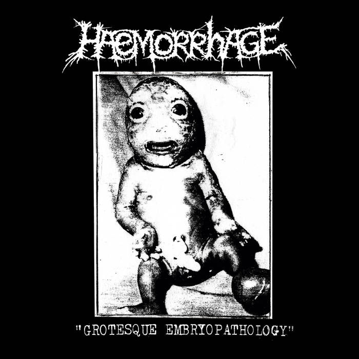 Haemorrhage - Grotesque Embryopathology 10"