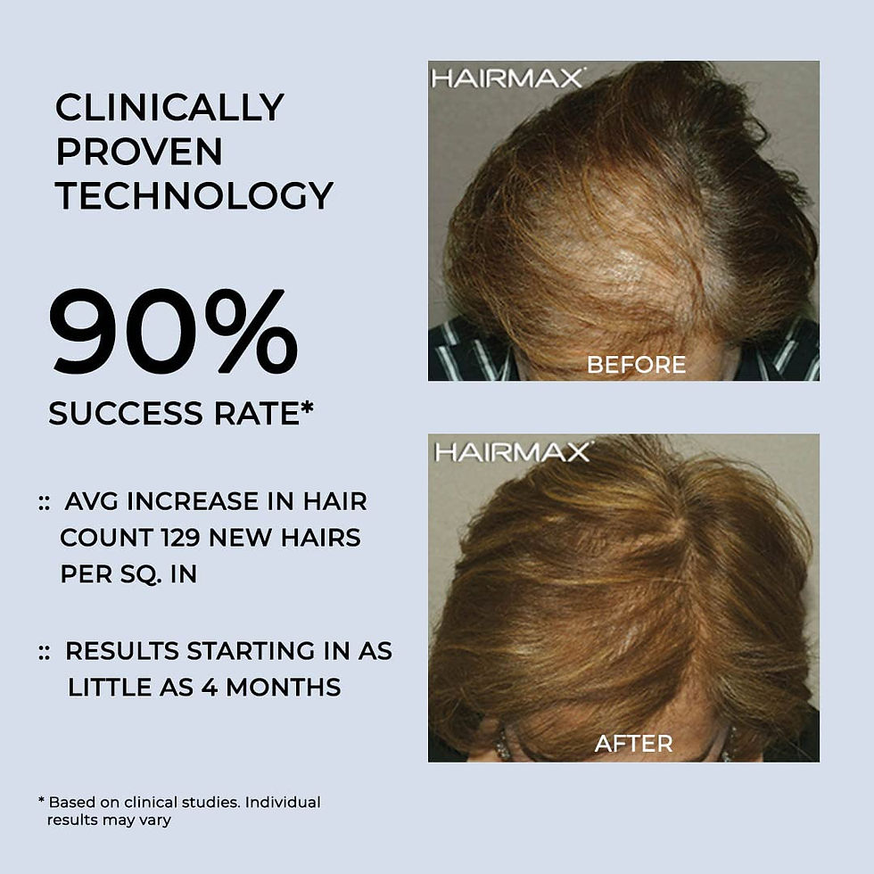 Thumbnail: Hairmax LaserBand 82 ComfortFlex (FDA Cleared)