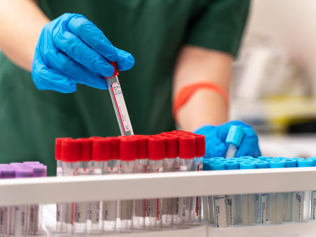Check-ups prontos: essa estratégia funciona para o laboratório?