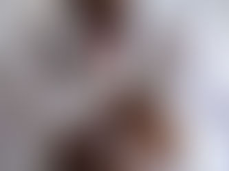 乾癬患者可以打新冠肺炎疫苗嗎?