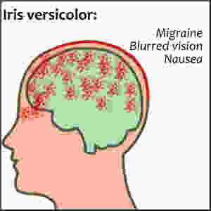 Homeopathy for Headaches | Musings of a Modern Hippie