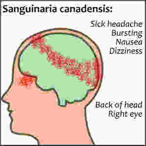 Homeopathy for Headaches | Musings of a Modern Hippie