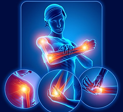 Upper Body Kinetic Chain Issues