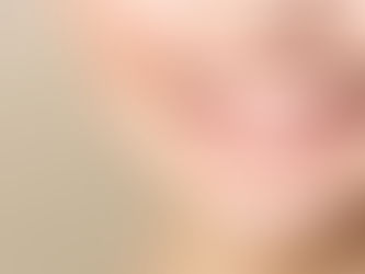 Clareamento dental: conheça os tipos e os cuidados