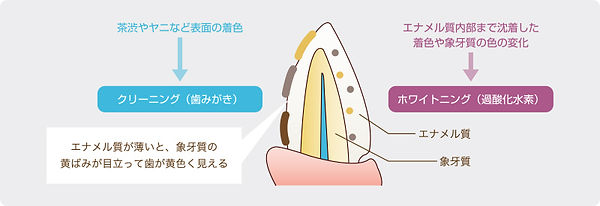 ポリリンプラチナホワイトニング