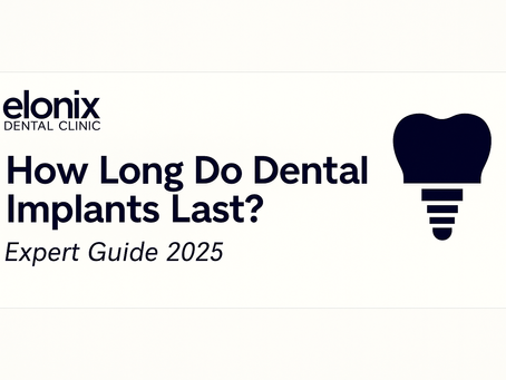 Infografía en español que muestra la vida útil de los implantes dentales frente a otras prótesis, factores que influyen en su durabilidad, mantenimiento recomendado y la garantía de 5 años ofrecida por Elonix Dental Clinic.