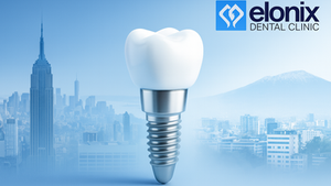 Infografía que compara el coste de implantes dentales en EE. UU. frente a Albania, destacando precios, ahorro y beneficios del turismo dental.