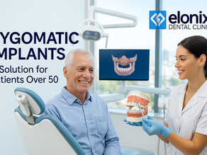 Dentist explaining zygomatic implants to a smiling male patient over 50 inside Elonix Dental Clinic, with implant model and digital 3D diagram on screen, representing advanced dental care in Albania.
