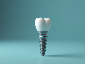 Comprehensive Guide to Types of Dental Implants
