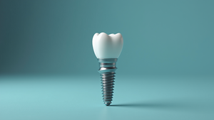 Comprehensive Guide to Types of Dental Implants