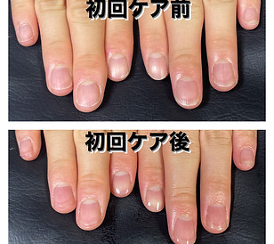 最強のネイルケアメソッド