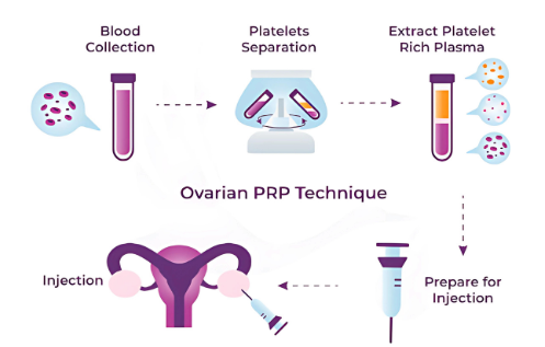 Ovarian PRP Process