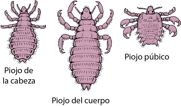skn_lice_es.gif?la=es&thn=0.gif