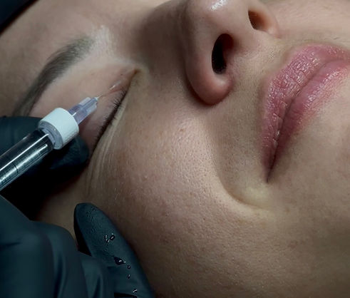 Client receiving Rejuran skin treatment at Melbourne clinic