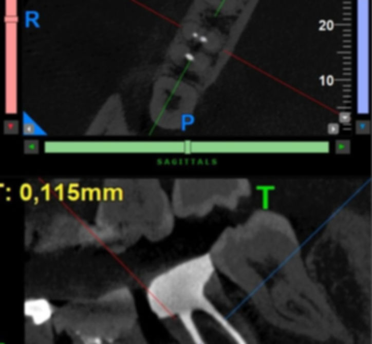 cbct.jpg