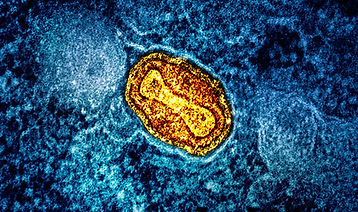 Microscopic view of monkeypox virus cell, orange and yellow color.