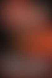 107. William Lashner - The Accounting