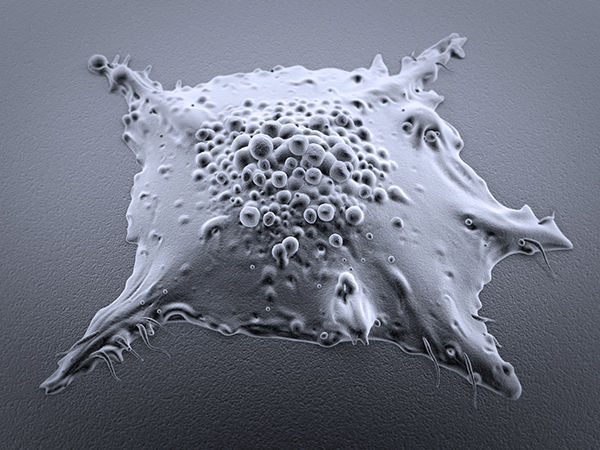 FDA Expands Use of Molecularly Targeted Therapeutic for Lung Cancer