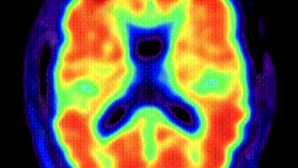 Colorful animated brain scan