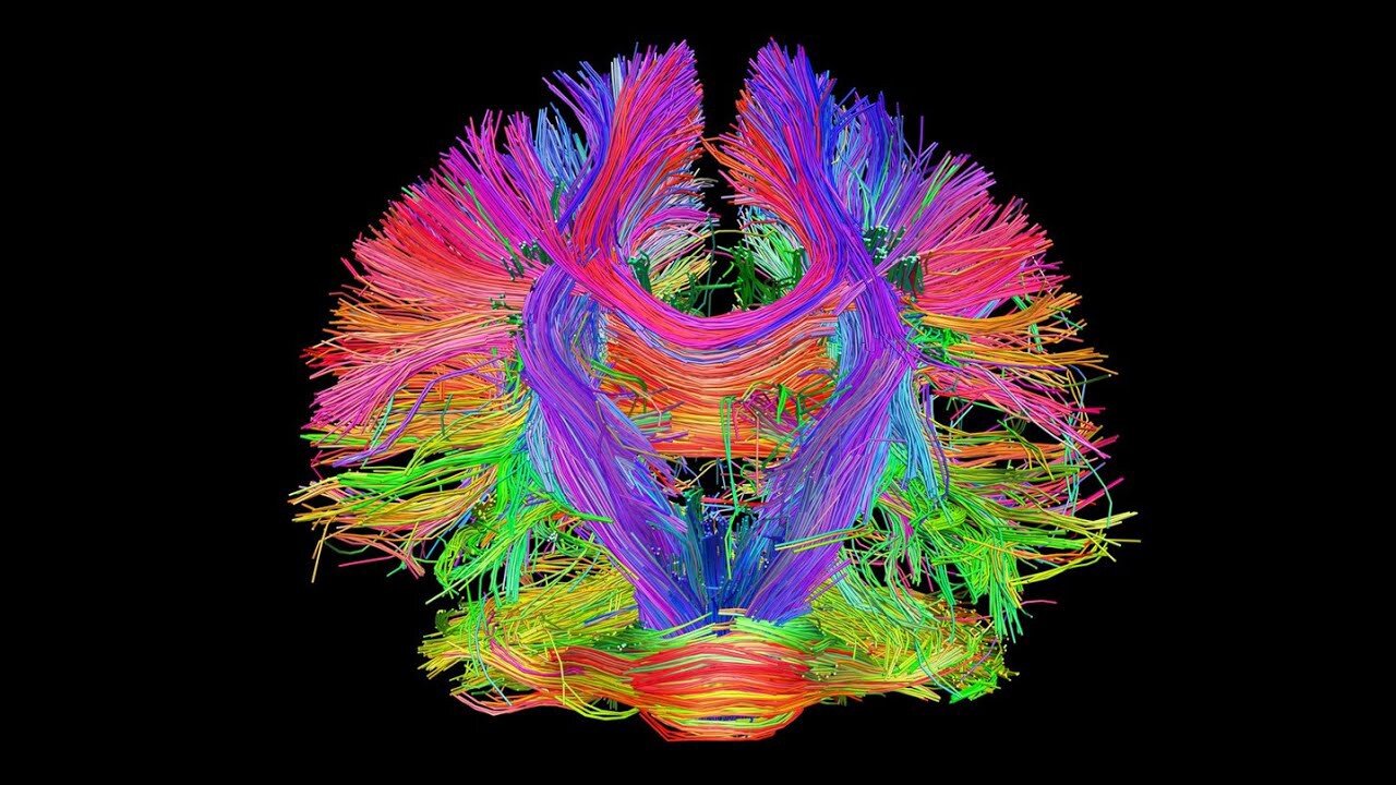 Small image of colorful brain connectome