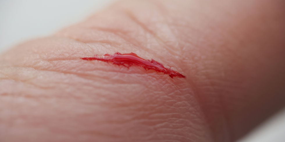 A Bleeding Laceration