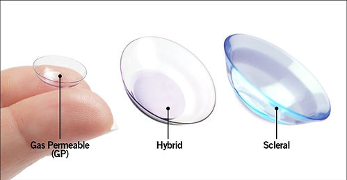 RGP Hybrid Scleral Lens