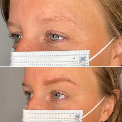 Microblading by Daisy, Client Before and After